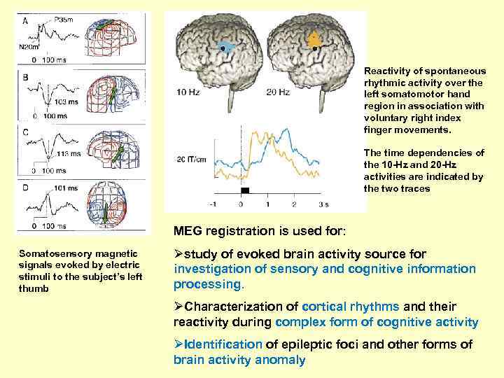 Reactivity of spontaneous rhythmic activity over the left somatomotor hand region in association with