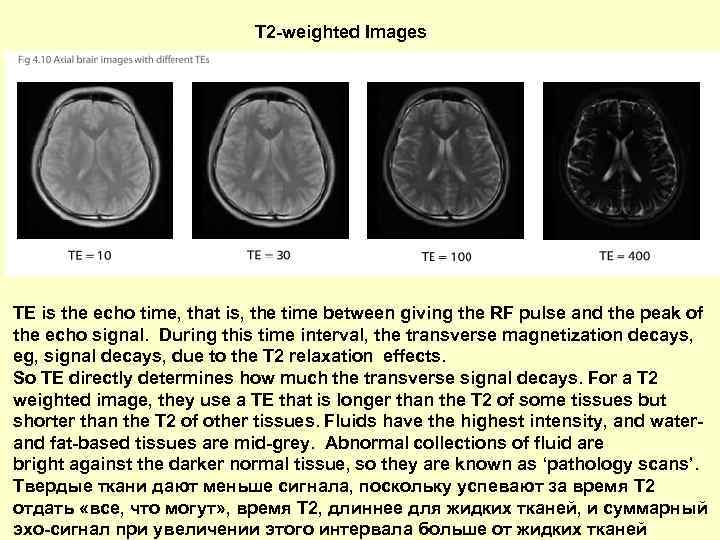 T 2 -weighted Images TE is the echo time, that is, the time between