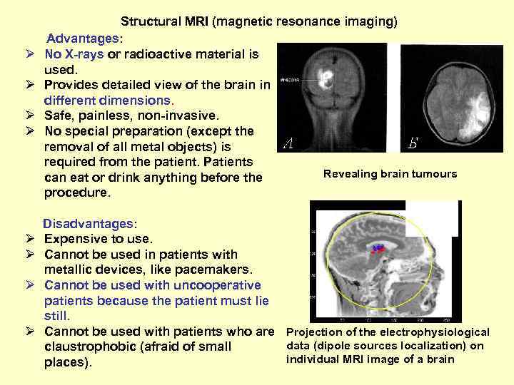 Structural MRI (magnetic resonance imaging) Advantages: Ø No X-rays or radioactive material is used.