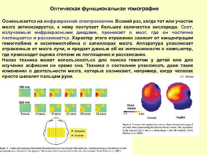 Оптическая функциональная томография Основывается на инфракрасной спектроскопии. Всякий раз, когда тот или участок мозга