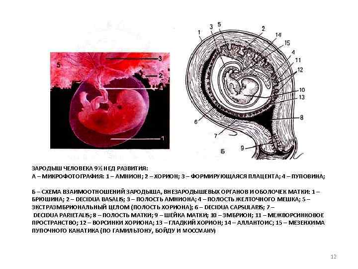 ЗАРОДЫШ ЧЕЛОВЕКА 9½ НЕД РАЗВИТИЯ: А – МИКРОФОТОГРАФИЯ: 1 – АМНИОН; 2 – ХОРИОН;
