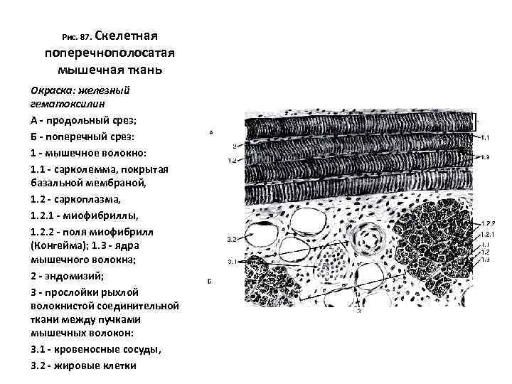 Рис. 87. Скелетная поперечнополосатая мышечная ткань Окраска: железный гематоксилин А - продольный срез; Б