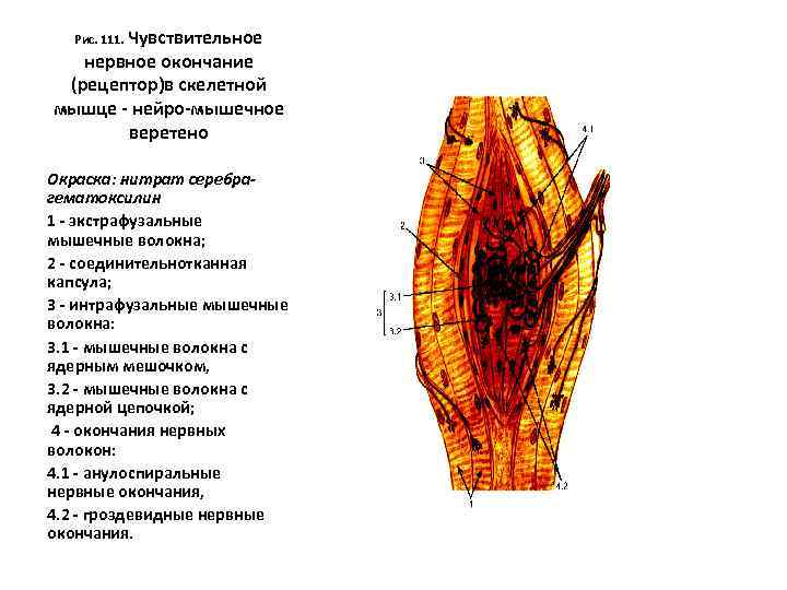 Рис. 111. Чувствительное нервное окончание (рецептор)в скелетной мышце - нейро-мышечное веретено Окраска: нитрат серебрагематоксилин