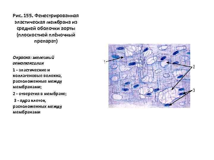 Рис. 155. Фенестрированная эластическая мембрана из средней оболочки аорты (плоскостной плёночный препарат) Окраска: железный