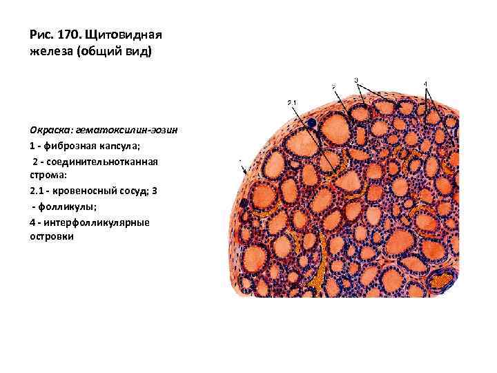 Рис. 170. Щитовидная железа (общий вид) Окраска: гематоксилин-эозин 1 - фиброзная капсула; 2 -