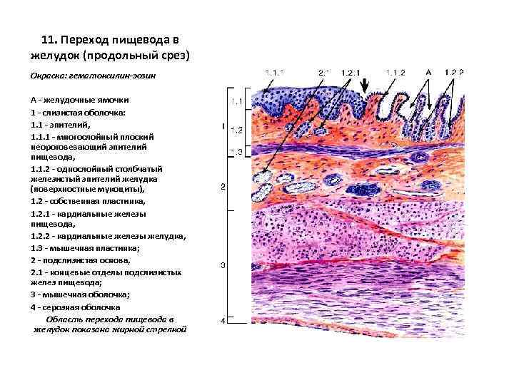 11. Переход пищевода в желудок (продольный срез) Окраска: гематоксилин-эозин А - желудочные ямочки 1