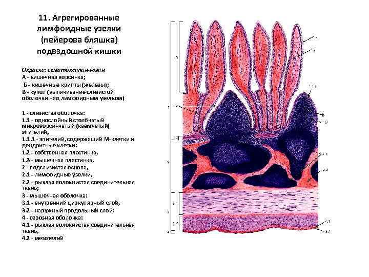 11. Агрегированные лимфоидные узелки (пейерова бляшка) подвздошной кишки Окраска: гематоксилин-эозин А - кишечная ворсинка;