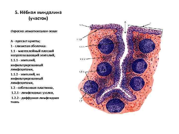 5. Нёбная миндалина (участок) Окраска: гематоксилин-эозин А - просвет крипты; 1 - слизистая оболочка: