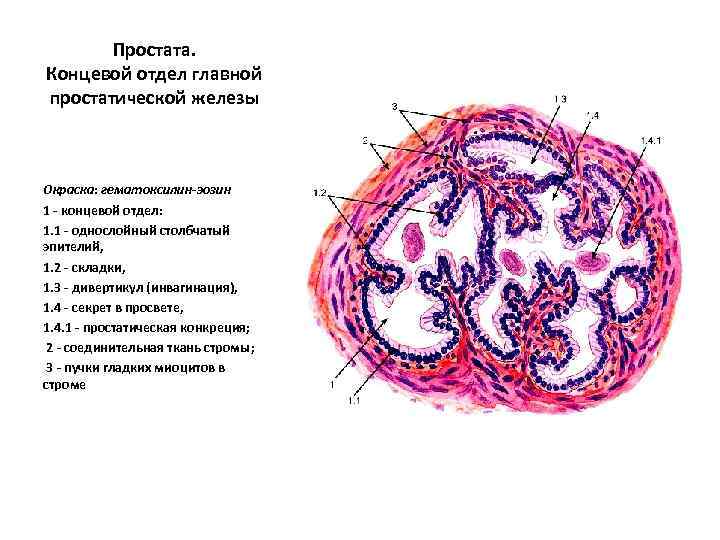 Простата. Концевой отдел главной простатической железы Окраска: гематоксилин-эозин 1 - концевой отдел: 1. 1