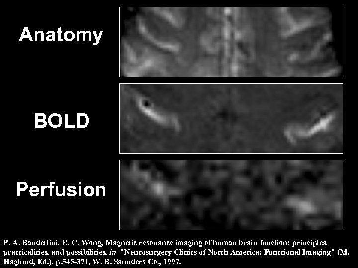 Anatomy BOLD Perfusion P. A. Bandettini, E. C. Wong, Magnetic resonance imaging of human