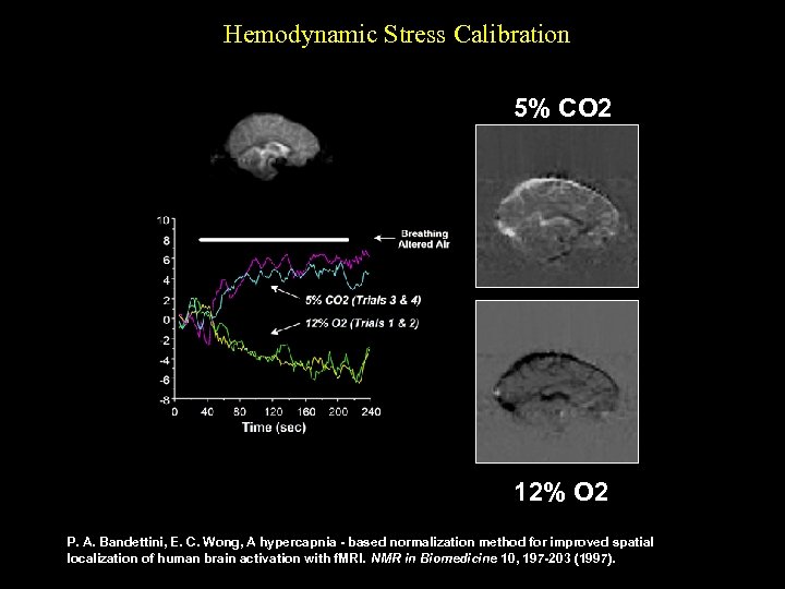 Hemodynamic Stress Calibration 5% CO 2 12% O 2 P. A. Bandettini, E. C.