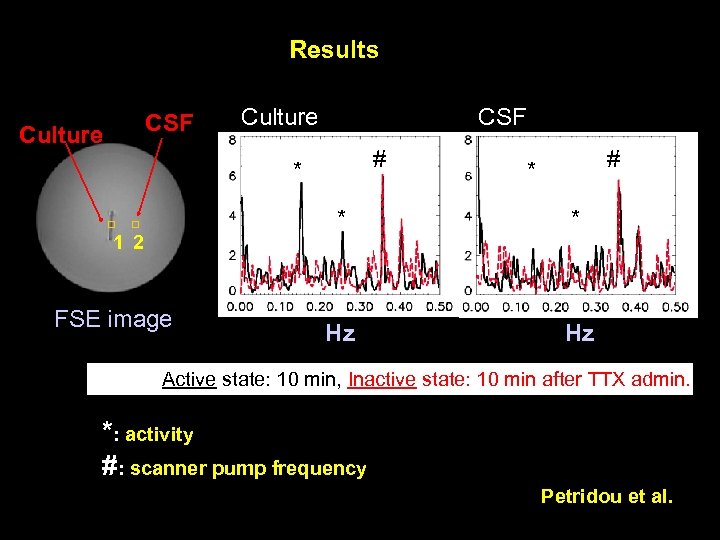 Results CSF Culture CSF # * * 1 2 FSE image * Hz Hz