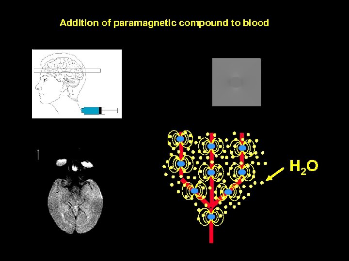 Addition of paramagnetic compound to blood H 2 O 