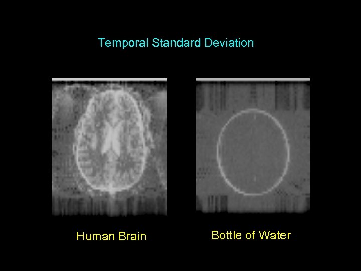 Temporal Standard Deviation Human Brain Bottle of Water 