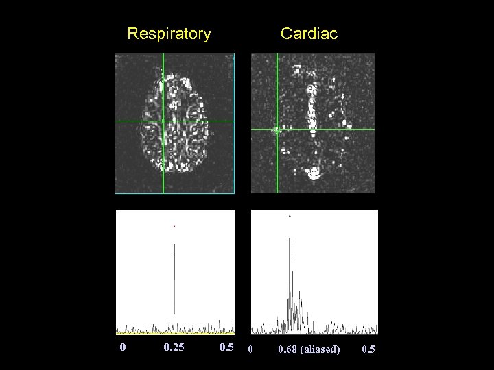 Respiratory 0 0. 25 Cardiac 0. 5 0 0. 68 (aliased) 0. 5 