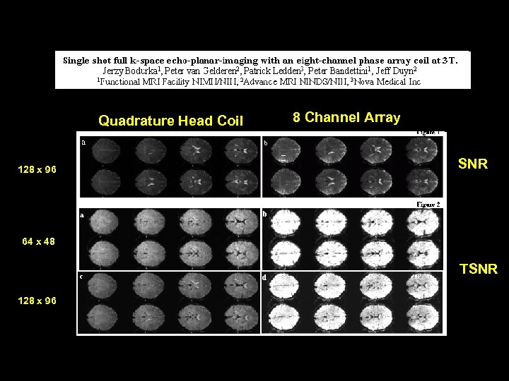Quadrature Head Coil 128 x 96 8 Channel Array SNR 64 x 48 TSNR