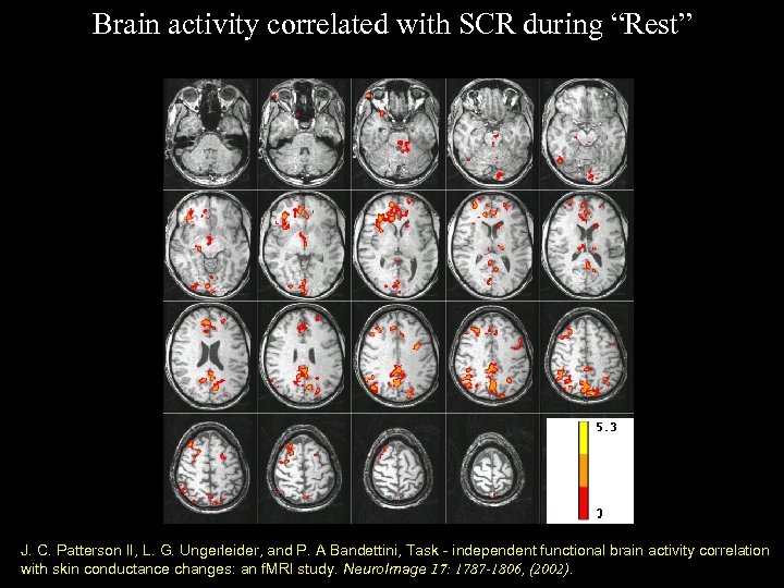 Brain activity correlated with SCR during “Rest” J. C. Patterson II, L. G. Ungerleider,