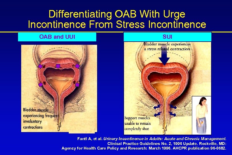 Differentiating OAB With Urge Incontinence From Stress Incontinence OAB and UUI SUI Fantl A,