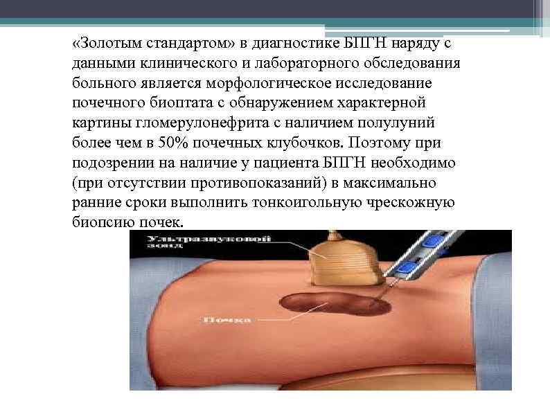  «Золотым стандартом» в диагностике БПГН наряду с данными клинического и лабораторного обследования больного