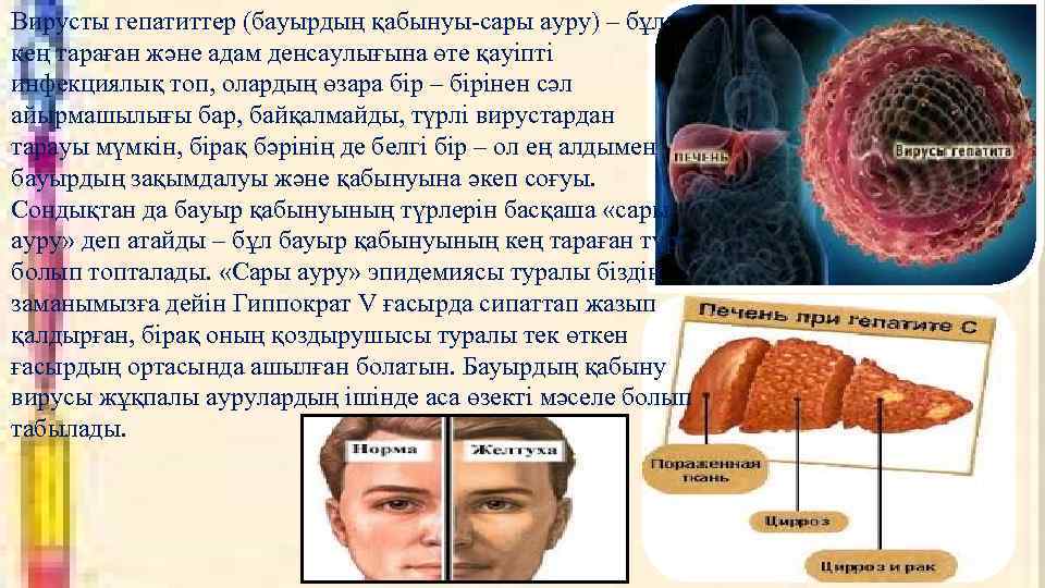 Сары ауру дегеніміз не презентация