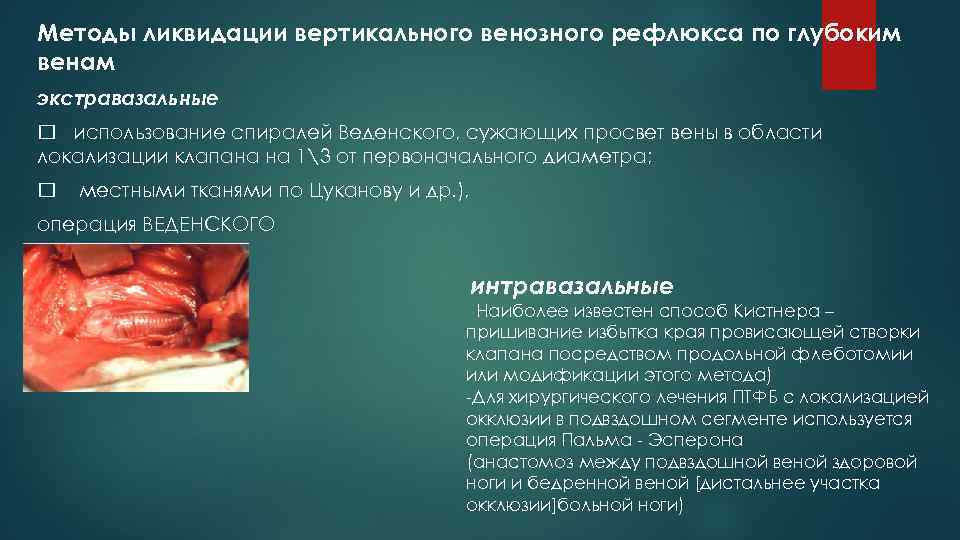 Методы ликвидации вертикального венозного рефлюкса по глубоким венам экстравазальные использование спиралей Веденского, сужающих просвет