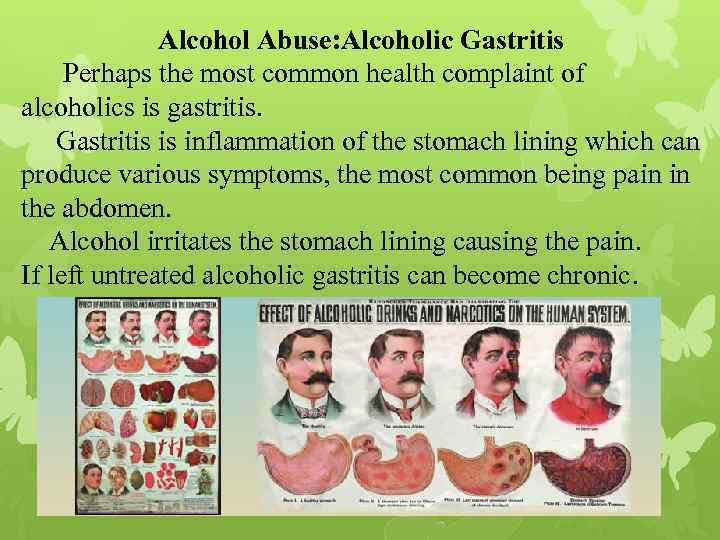 Alcohol Abuse: Alcoholic Gastritis Perhaps the most common health complaint of alcoholics is gastritis.