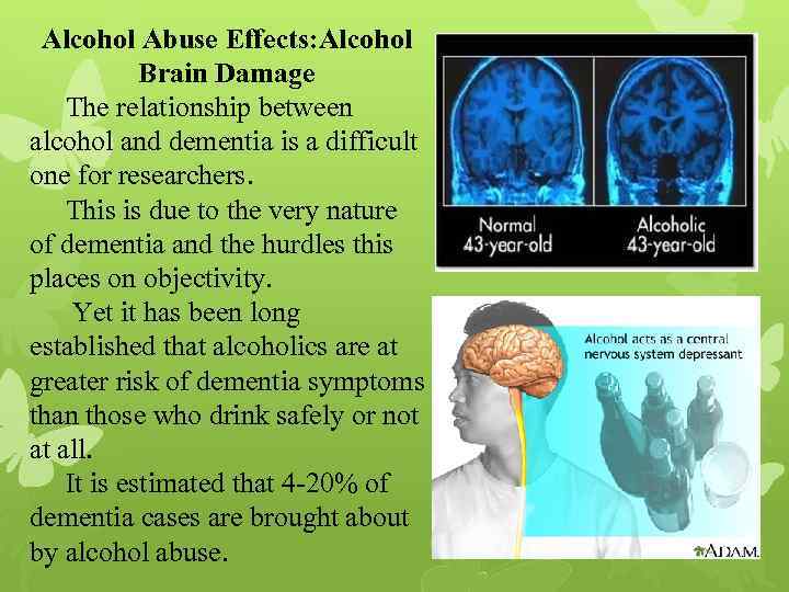 Alcohol Abuse Effects: Alcohol Brain Damage The relationship between alcohol and dementia is a