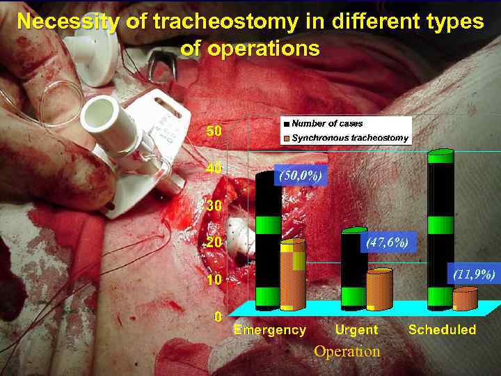 Necessity of tracheostomy in different types of operations (50, 0%) (47, 6%) (11, 9%)