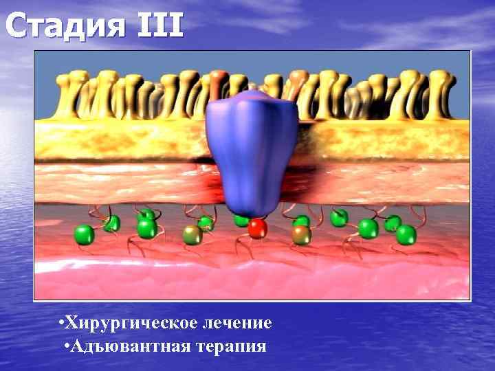 Стадия III • Хирургическое лечение • Адъювантная терапия 