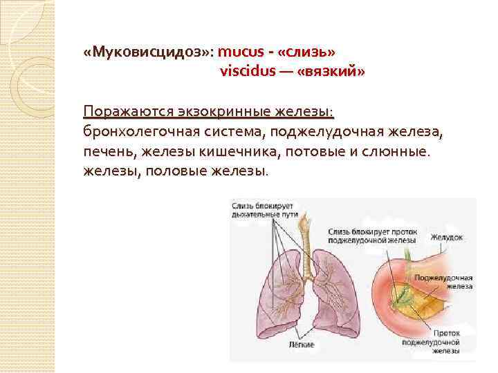  «Муковисцидоз» : mucus - «слизь» viscidus — «вязкий» Поражаются экзокринные железы: бронхолегочная система,