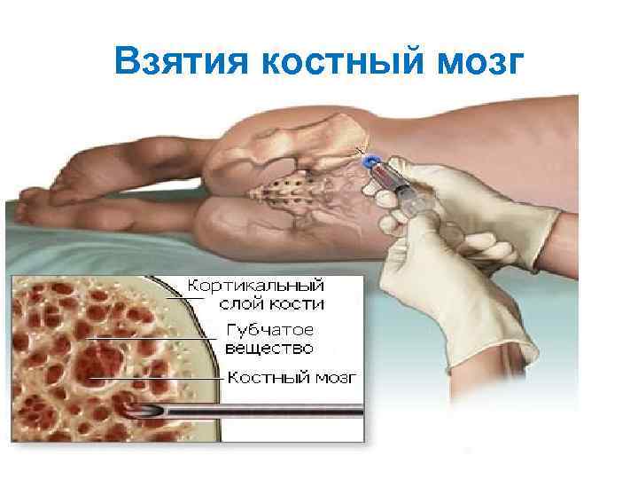 Взятия костный мозг 