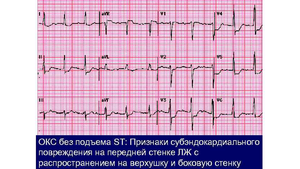 Окс карта смп