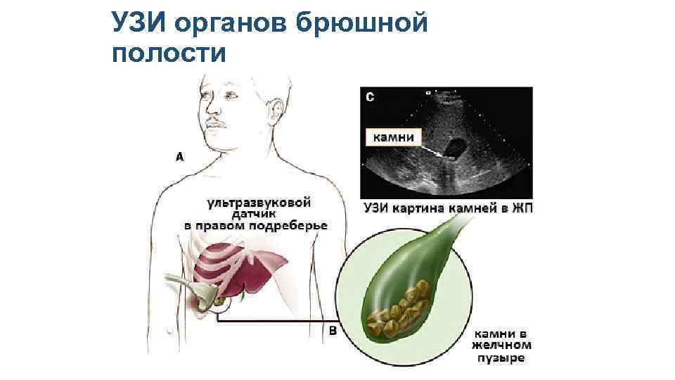 УЗИ органов брюшной полости 