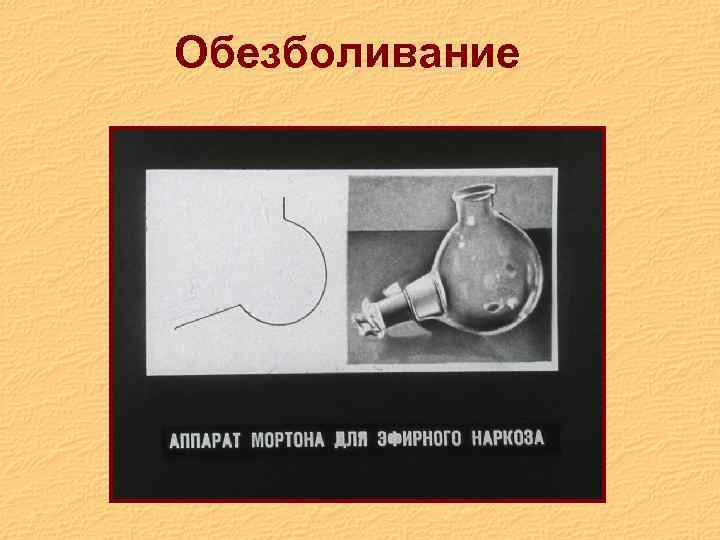 Обезболивание 