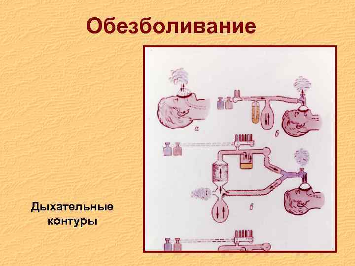Обезболивание Дыхательные контуры 
