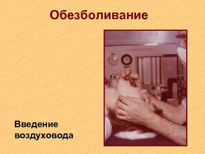 Обезболивание Введение воздуховода 