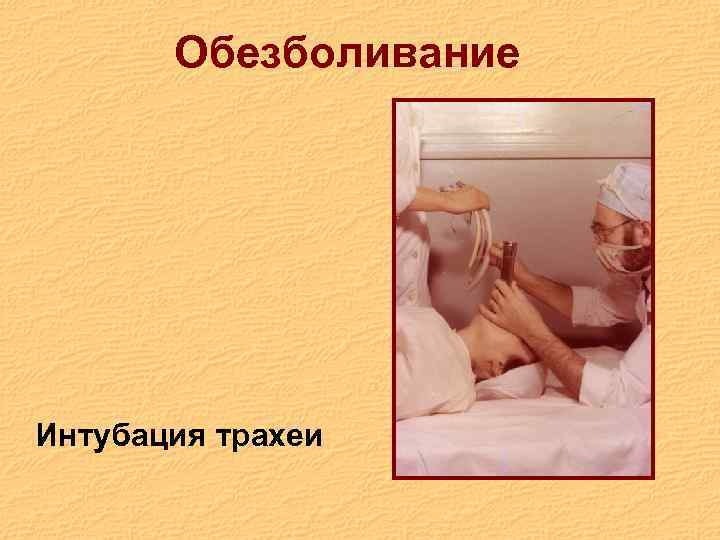 Обезболивание Интубация трахеи 