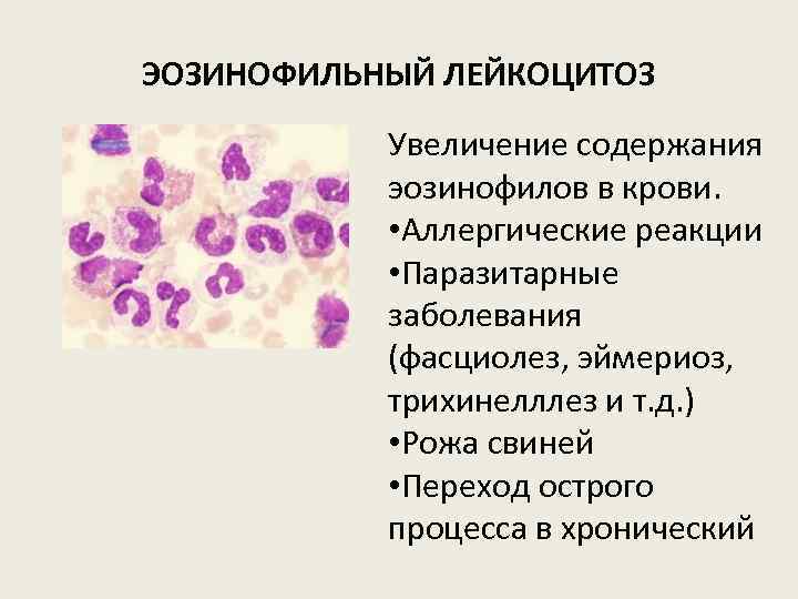 ЭОЗИНОФИЛЬНЫЙ ЛЕЙКОЦИТОЗ Увеличение содержания эозинофилов в крови. • Аллергические реакции • Паразитарные заболевания (фасциолез,