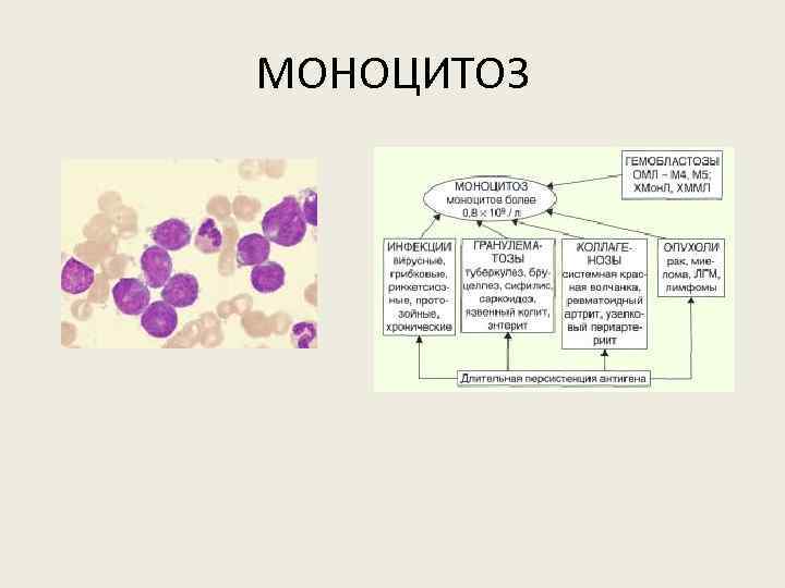 МОНОЦИТОЗ 