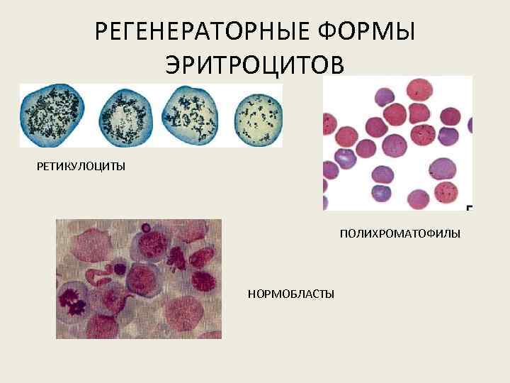 Нормобласты