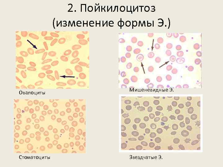 Физиология крови картинки