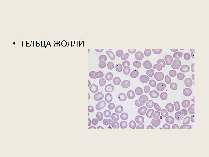  • ТЕЛЬЦА ЖОЛЛИ 