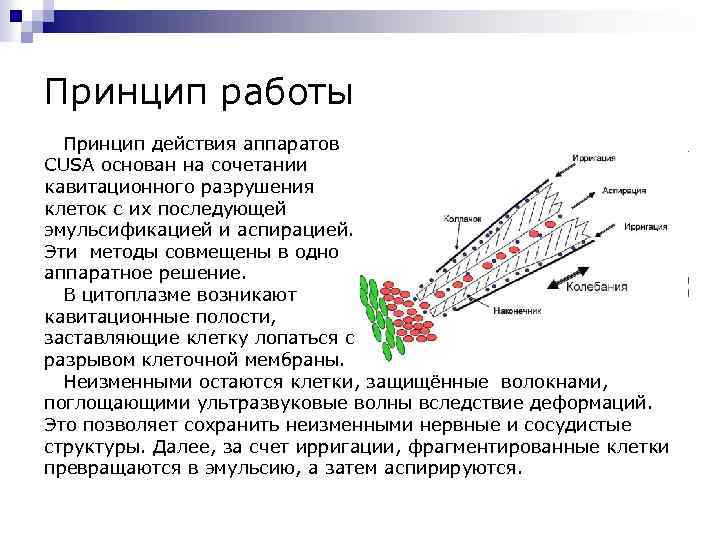 Принцип работы Принцип действия аппаратов CUSA основан на сочетании кавитационного разрушения клеток с их