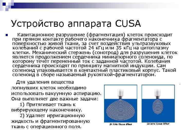 Устройство аппарата CUSA n Кавитационное разрушение (фрагментация) клеток происходит при прямом контакте рабочего наконечника