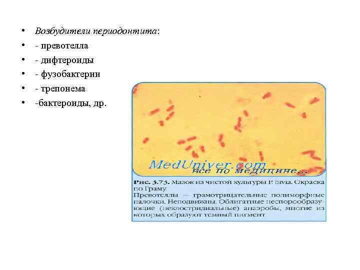  • • • Возбудители периодонтита: - превотелла - дифтероиды - фузобактерии - трепонема