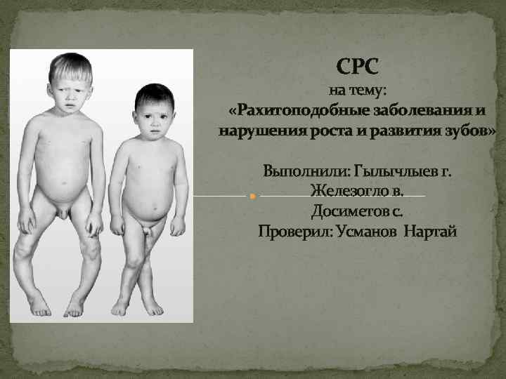  СРС на тему: «Рахитоподобные заболевания и нарушения роста и развития зубов» Выполнили: Гылычлыев