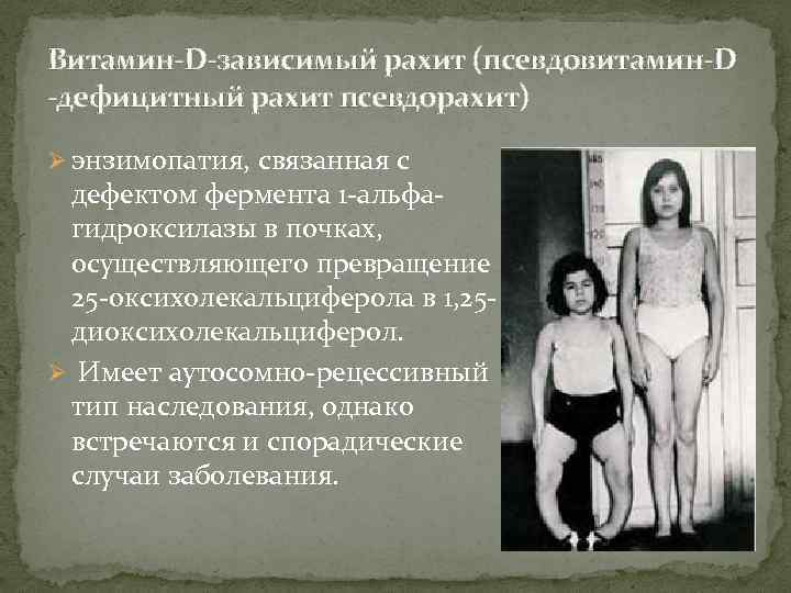 Витамин-D-зависимый рахит (псевдовитамин-D -дефицитный рахит псевдорахит) Ø энзимопатия, связанная с дефектом фермента 1 -альфагидроксилазы