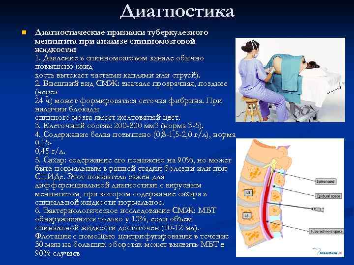 Диагностика n Диагностические признаки туберкулезного менингита при анализе спинномозговой жидкости: 1. Давление в спинномозговом