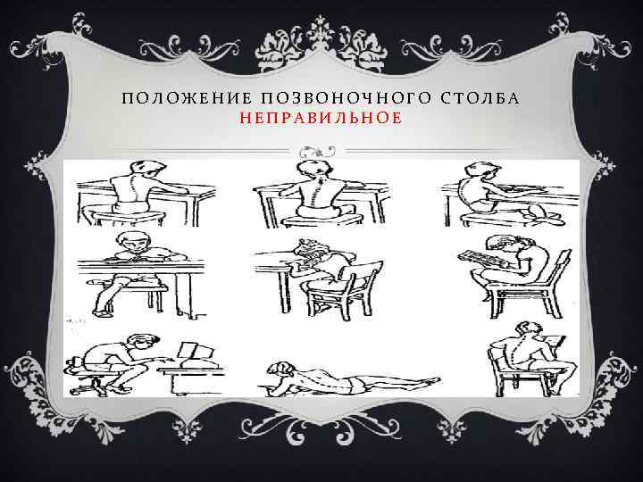ПОЛОЖЕНИЕ ПОЗВОНОЧНОГО СТОЛБА НЕПРАВИЛЬНОЕ 