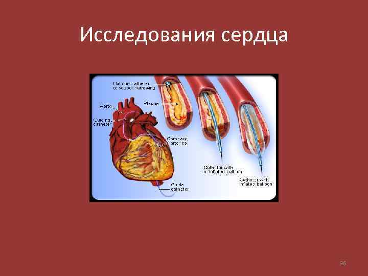 Исследования сердца 36 